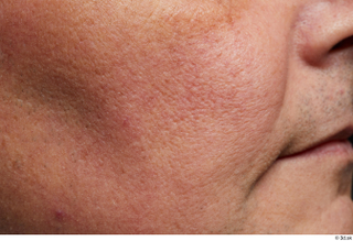 HD Face Skin Reuben Panjaitan cheek face skin pores skin…